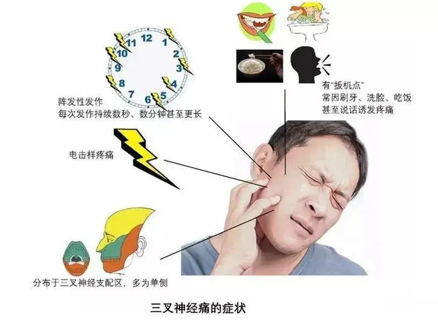 脸疼app_欧莱雅的水为什么脸疼_涂上屈臣氏睡眠面膜脸疼