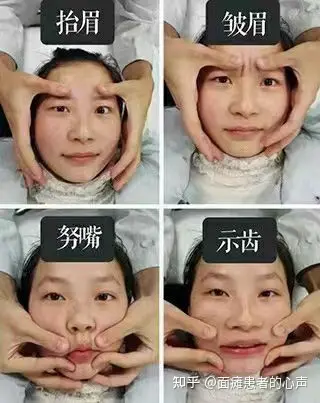 专治面瘫的手机游戏_面瘫神器_治疗面瘫有没有什么特殊好玩