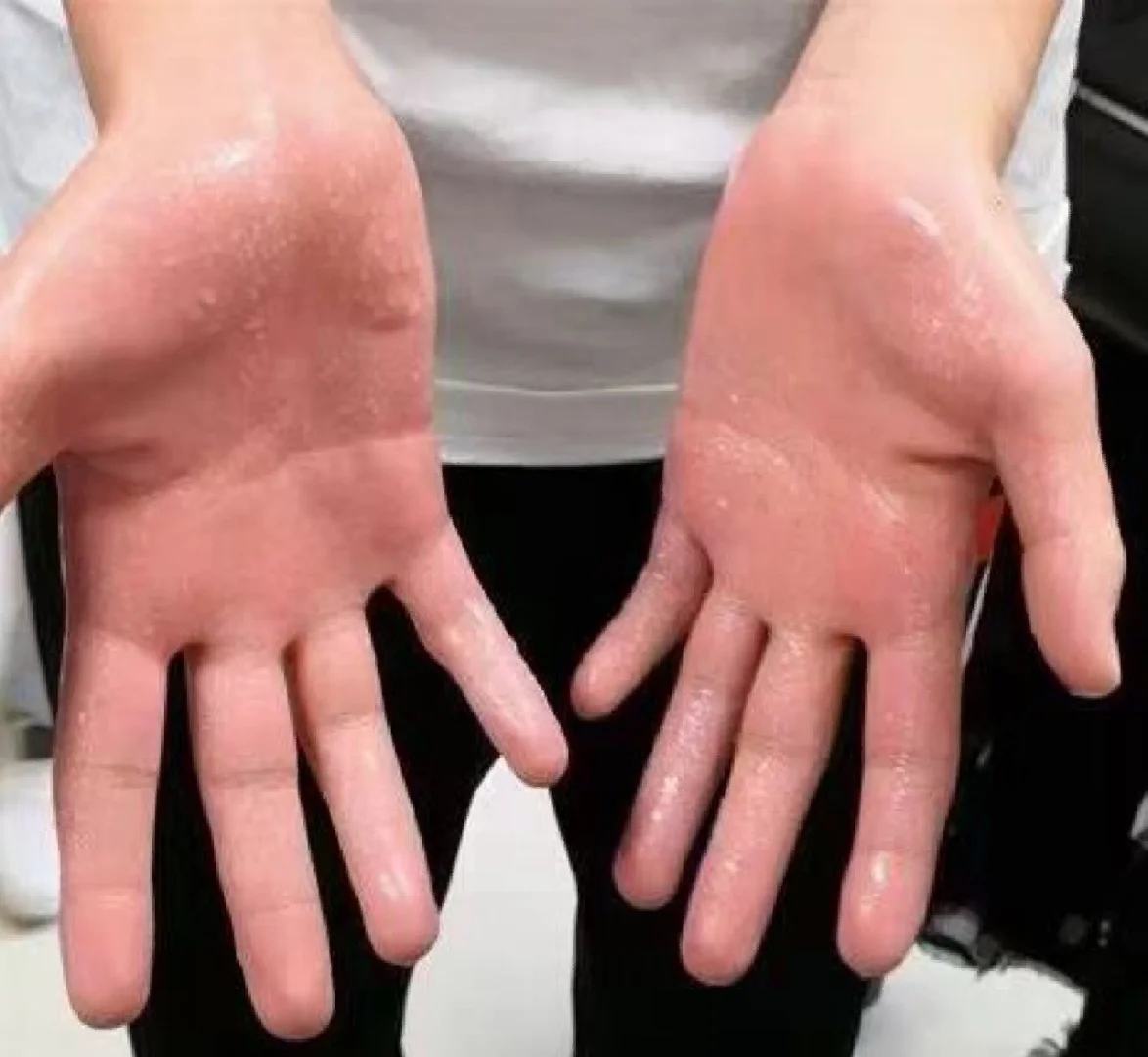 玩手游防止出汗_手机游戏防出汗_玩游戏防出汗