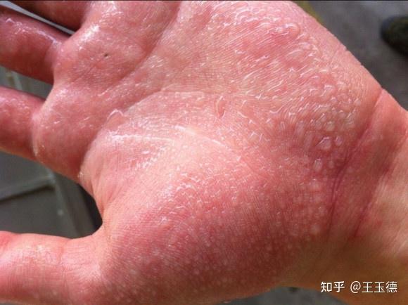 手机游戏防出汗_玩游戏防出汗_玩手游防止出汗